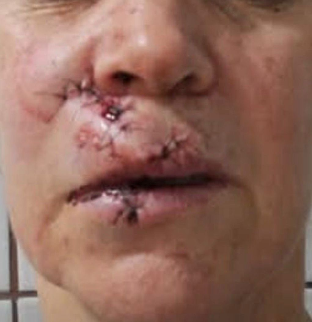 Homem preso após agressão a mulher em Ribeirão Pires é solto após audiência de custódia